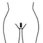 wax-treatments---A-Brazilian